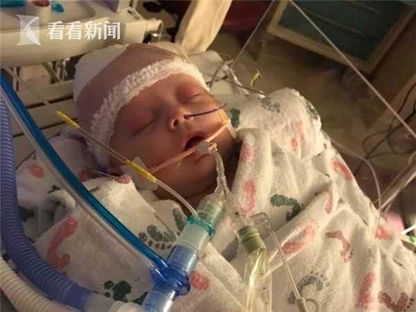 月嫂疏忽致29天婴儿重摔颅内出血这是一个非常严重的情况，需要立即寻求医疗帮助。颅内出血可能会对婴儿的健康造成长期影响，甚至危及生命。作为家长或监护人，应该尽快将婴儿送往医院接受专业医生的评估和治疗。